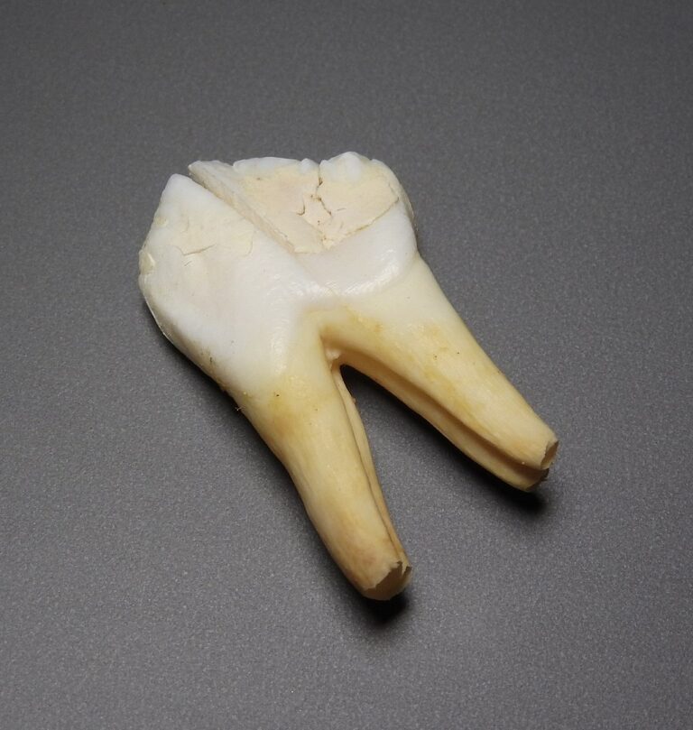 Broken Tooth By Ace Boggess